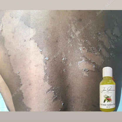 Jiore Tsuyoi Oil Skin Whitening Yellow Peel Brightening & Exfoliating Treatment Skin